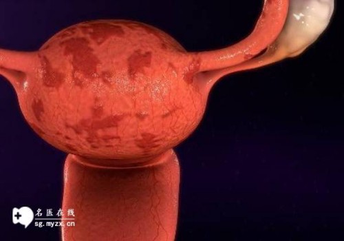 汕头助孕：着床早好还是着床晚好,着床时间要因人而异